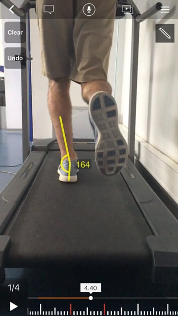 pronation-G