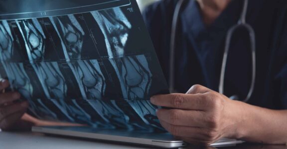 Imagerie médicale