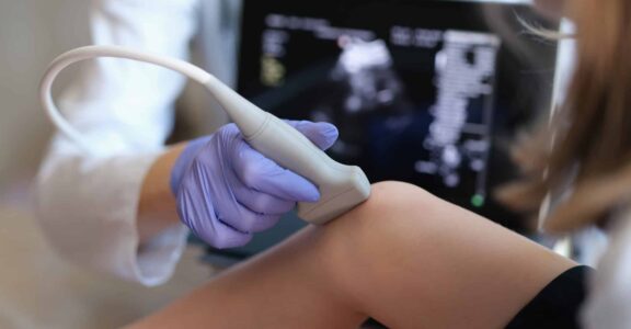 Traitement de l’arthrose